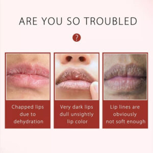 Sugar Lip Scrub - Gentle Lip Care Lip Exfoliator & Moisturizer - Exfoliating Lip Scrubber for Dry Lips