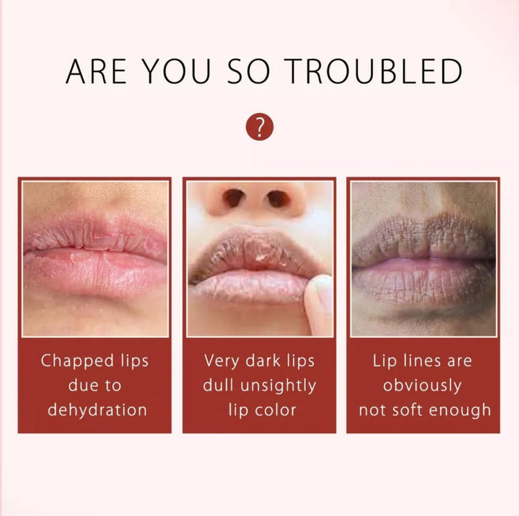 Sugar Lip Scrub - Gentle Lip Care Lip Exfoliator & Moisturizer - Exfoliating Lip Scrubber for Dry Lips - Image 3